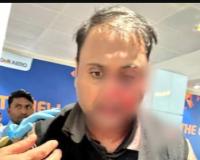 ਦਿੱਲੀ ਹਵਾਈ ਅੱਡੇ ਦੇ ਟਰਮੀਨਲ 1 'ਤੇ ਸ਼ੁੱਕਰਵਾਰ ਇਕ ਆਫ-ਡਿਊਟੀ ਪਾਇਲਟ ਨੇ ਇਕ ਯਾਤਰੀ ਨਾਲ ਕੁੱਟਮਾਰ ਕੀਤੀ