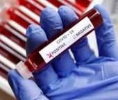 Corona Virus In Haryana: ਹਰਿਆਣਾ ਵਿੱਚ ਇੱਕ ਵਾਰ ਫਿਰ ਕੋਰੋਨਾ ਵਾਇਰਸ ਨੇ ਦਸਤਕ ਦੇ ਦਿੱਤੀ ਹੈ